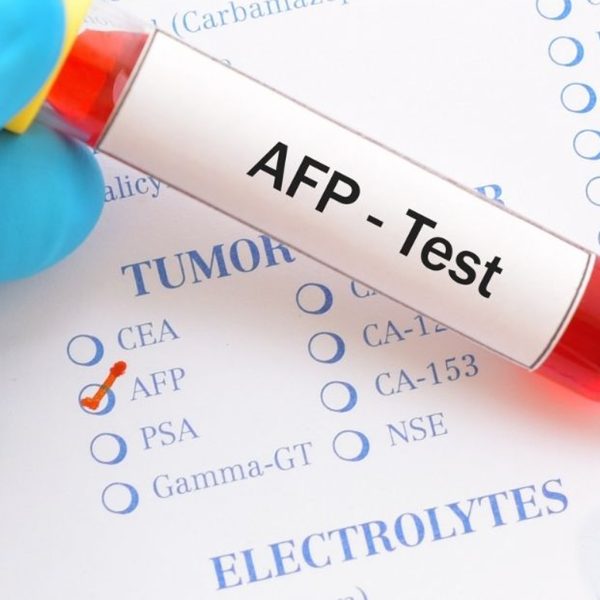 Alpha Feto Protein (AFP)