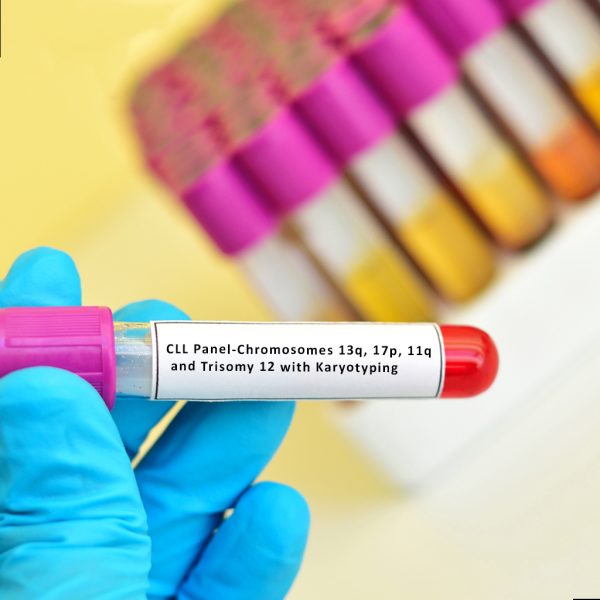 CLL Panel-Chromosomes